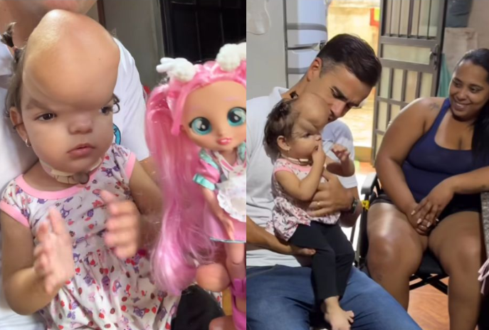 💛 Maria Júlia: 2 aninhos, um tumor gigante na cabeça e um único presente de aniversário — uma bonequinha enviada por um desconhecido da internet